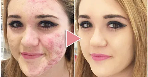 FV Skin Liquid Foundation Long-Lasting (IMPORTED)